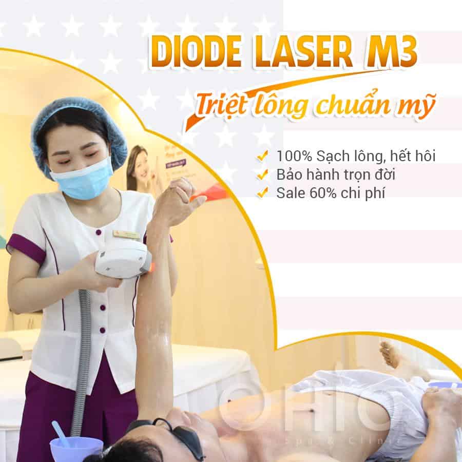 Có nên triệt lông cho nam không?